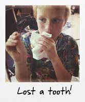 Lost a tooth!